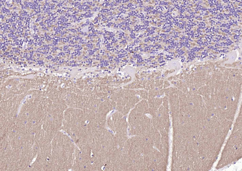 NCAM Recombinant Rabbit Monoclonal Antibody