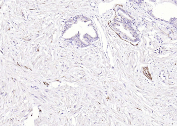 NCAM Recombinant Rabbit Monoclonal Antibody