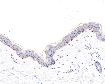 TYRP1 Recombinant Rabbit Monoclonal Antibody