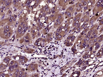 ZNRF3 Rabbit Polyclonal Antibody