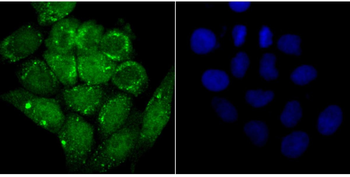 Alpha Synuclein Recombinant Rabbit Monoclonal Antibody