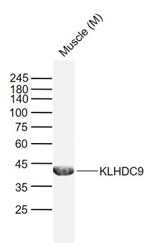 KLHDC9 Rabbit Polyclonal Antibody