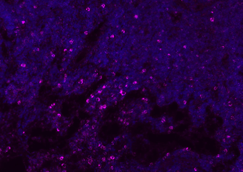 CD8B Rabbit Polyclonal Antibody
