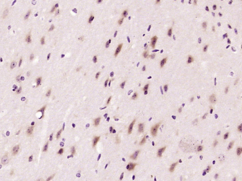AKD1 Rabbit Polyclonal Antibody
