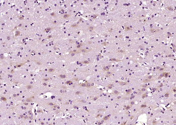 TPH2 Rabbit Polyclonal Antibody