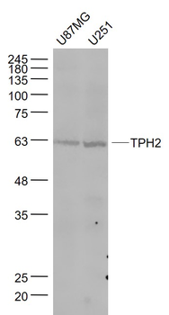 TPH2 Rabbit Polyclonal Antibody
