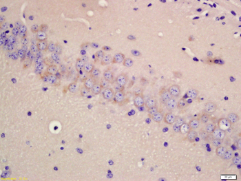 TPH2 Rabbit Polyclonal Antibody