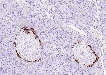 F(ab')₂ Fragment Goat Anti-Rabbit IgG H&L, HRP conjugated