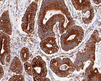 TGF alpha Recombinant Rabbit Monoclonal Antibody