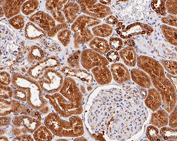 TGF alpha Recombinant Rabbit Monoclonal Antibody
