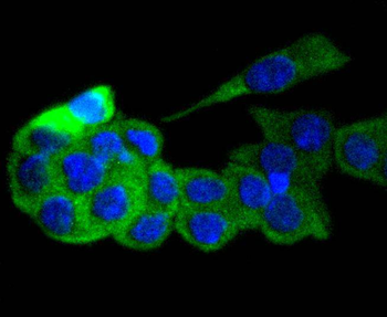 GART Recombinant Rabbit Monoclonal Antibody
