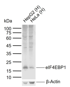 EIF4EBP1 Rabbit Polyclonal Antibody