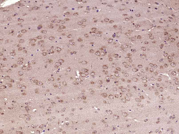 5HT4 Receptor Rabbit Polyclonal Antibody