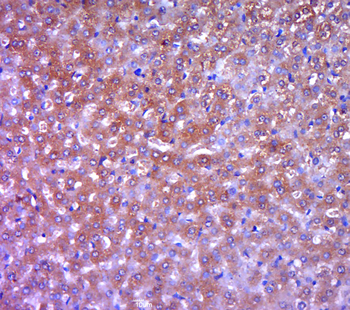 SHBG Rabbit Polyclonal Antibody