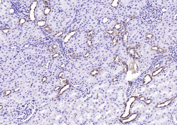 Angiotensin II type 1A receptor Rabbit Polyclonal Antibody