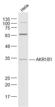 AKR1B1 Rabbit Polyclonal Antibody