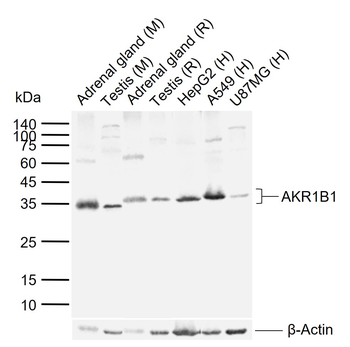 AKR1B1 Rabbit Polyclonal Antibody