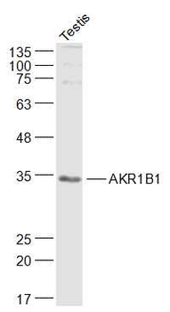 AKR1B1 Rabbit Polyclonal Antibody