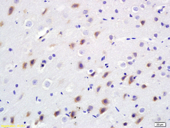 BDKRB2 Rabbit Polyclonal Antibody