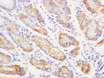 ENPP2 Rabbit Polyclonal Antibody