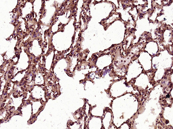 MESP1 Rabbit Polyclonal Antibody