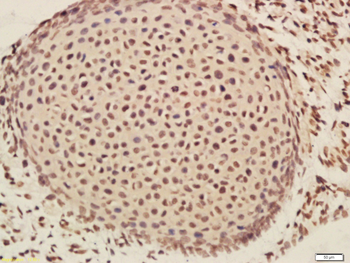 MESP1 Rabbit Polyclonal Antibody