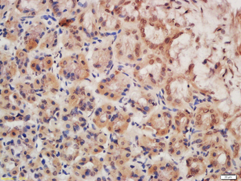 MESP1 Rabbit Polyclonal Antibody