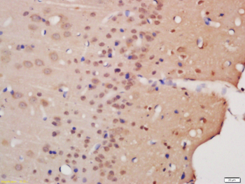 MESP1 Rabbit Polyclonal Antibody