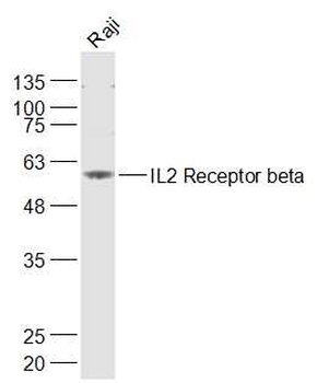 IL2 Receptor beta Rabbit Polyclonal Antibody