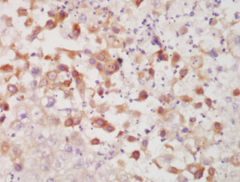 CK7 Rabbit Polyclonal Antibody