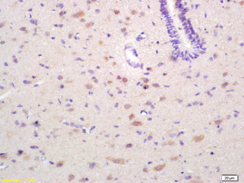 EPH receptor A4 Rabbit Polyclonal Antibody