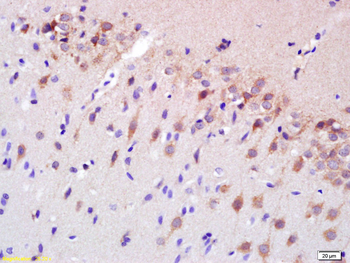 Spastin Rabbit Polyclonal Antibody