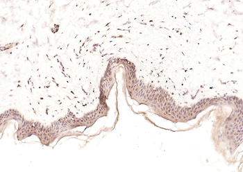HDAC2 Rabbit Polyclonal Antibody