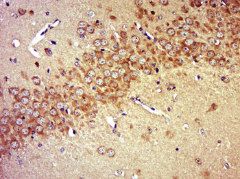 HRG1 Rabbit Polyclonal Antibody