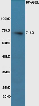 Pro-neuregulin-1, membrane-bound isoform Rabbit Polyclonal Antibody