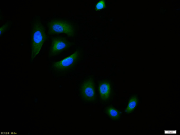 Phospho-IKB alpha (Ser32 + Ser36) Rabbit Polyclonal Antibody