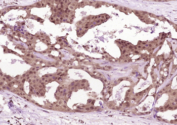 IL-1R2 Rabbit Polyclonal Antibody