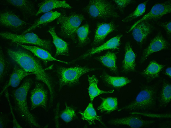 Phospho-JAK2 (Tyr1007+Tyr1008) Rabbit Polyclonal Antibody