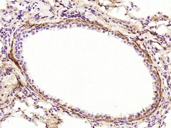 Phospho-JAK2 (Tyr1007+Tyr1008) Rabbit Polyclonal Antibody