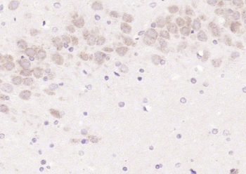 LCAT Rabbit Polyclonal Antibody