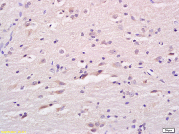 LCAT Rabbit Polyclonal Antibody