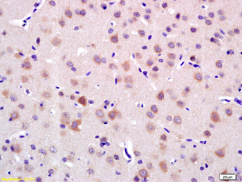 LRIG1 Rabbit Polyclonal Antibody