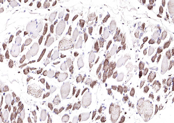 Fbx32 Rabbit Polyclonal Antibody