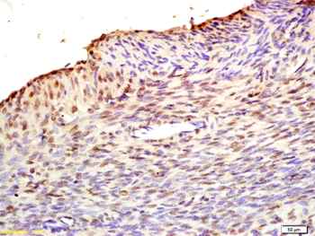 Fbx32 Rabbit Polyclonal Antibody