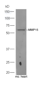 MMP15 Rabbit Polyclonal Antibody