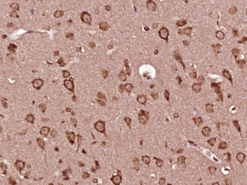 Alpha MSH Rabbit Polyclonal Antibody