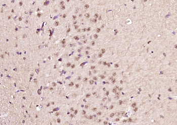 MDC1 Rabbit Polyclonal Antibody