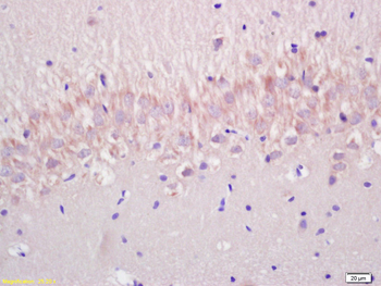 P53 (wt-p53) Rabbit Polyclonal Antibody