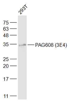 PAG608 Mouse Monoclonal Antibody