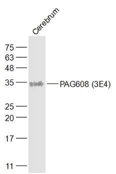 PAG608 Mouse Monoclonal Antibody